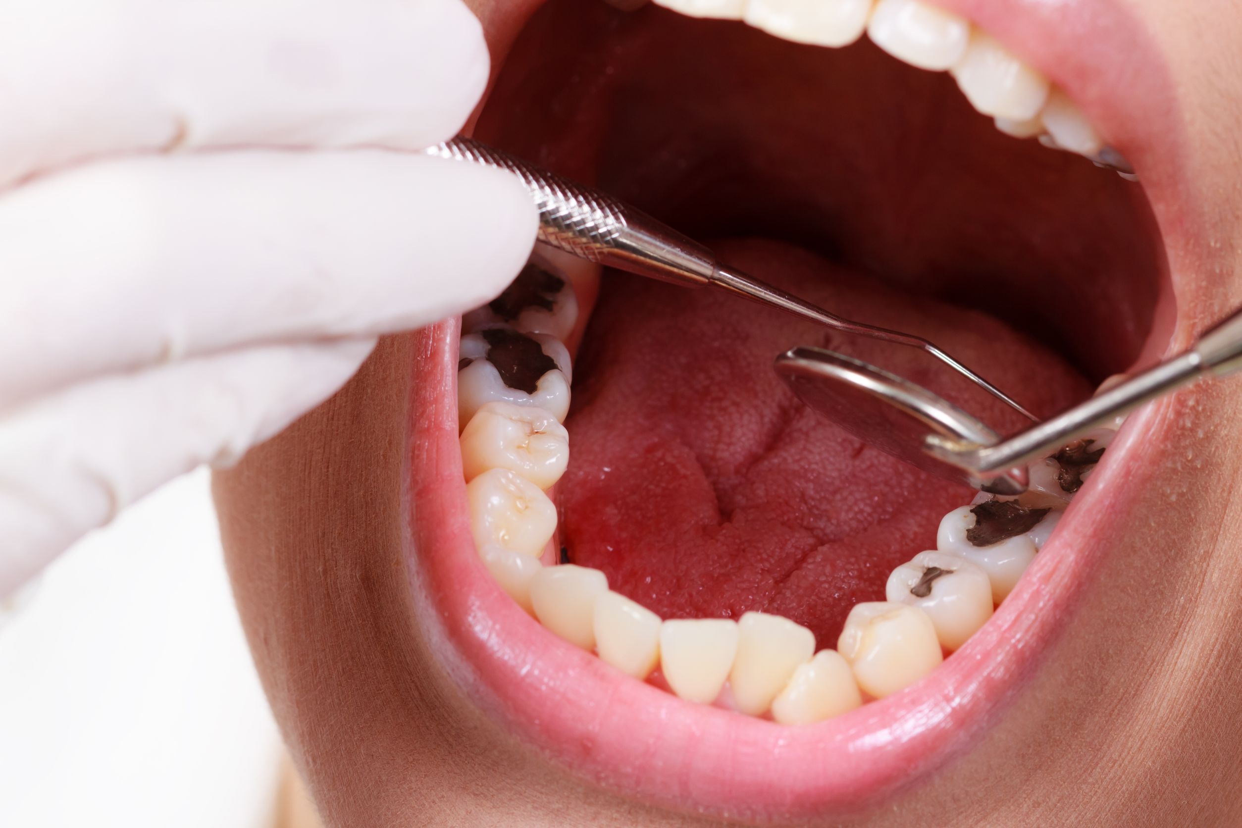 Overcoming Your Fear of the Dentist in Fairfield, CT